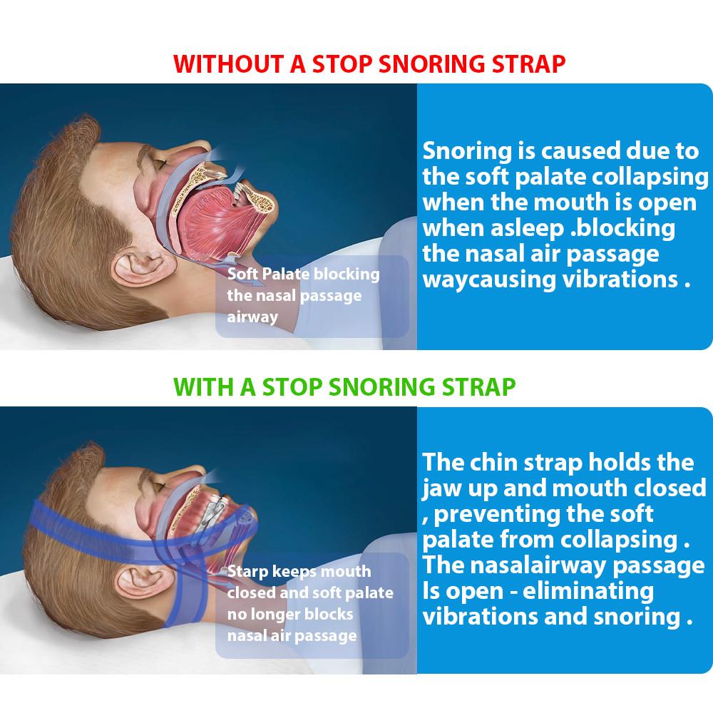 how stop snoring strap works