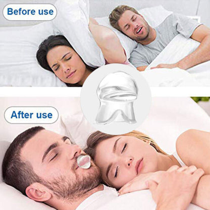 2pcs Anti Snoring Tongue Device Silicone Sleep Apnea Aid Stop Snoring